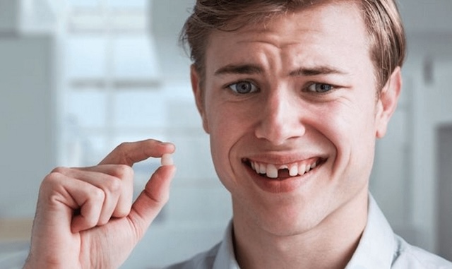 Giải mã chi tiết các giấc mơ về răng vỡ vụn Giải mã chi tiết các giấc mơ về răng vỡ vụn